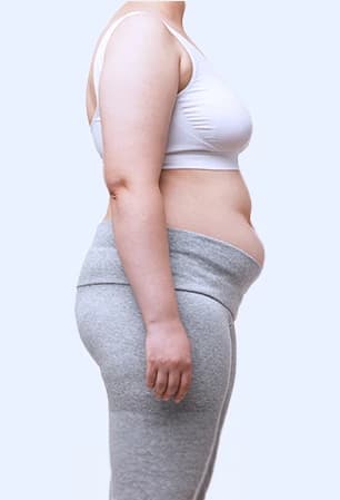 Bariatrie-Chirurgie
