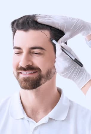 Haartransplantation