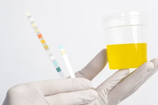 What Causes Cloudy Urine Erdem Hospital And Health Group