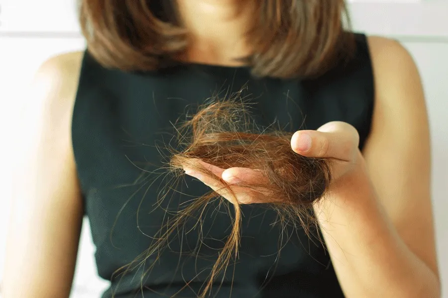 Hair Loss After Weight Loss