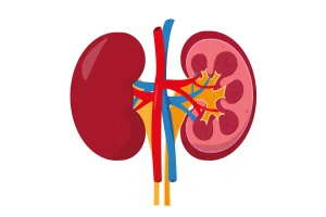 Pyeloplasty in Turkey