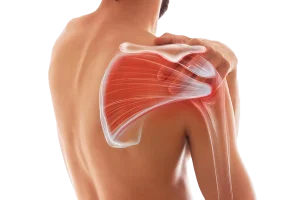 Shoulder Arthroscopy Surgery in Turkey