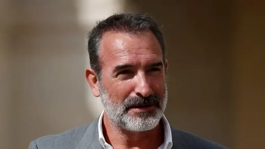 Jean Dujardin Hair Transplant