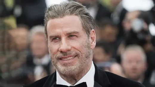 John Travolta Hair Transplant