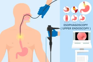 Esophageal Manometry in Turkey