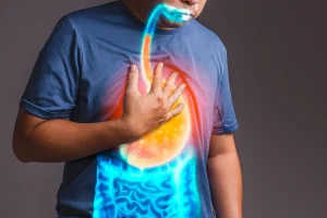 GERD Reflux in Turkey