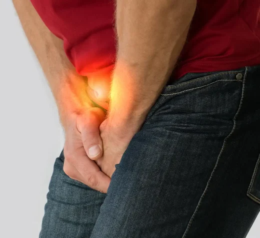 Prostatectomy or HoLEP? Understanding the Surgical Options for Prostate Cancer 6 Prostatectomy or HoLEP? Understanding the Surgical Options for Prostate Cancer