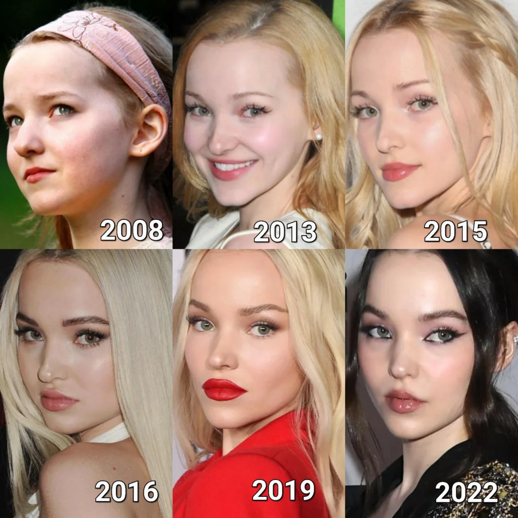 Chirurgia plastica di Dove Cameron: la trasformazione nel corso degli anni