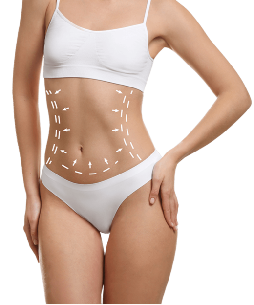 tummy tuck red bg