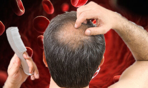 Will Taking Iron Supplements Help with Hair Loss?