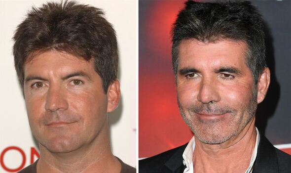 El rostro de Simon Cowell: antes y ahora con debates sobre cirugía plástica