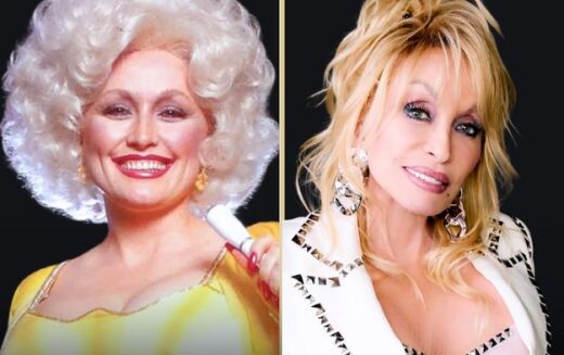 Dolly Parton Face Lift