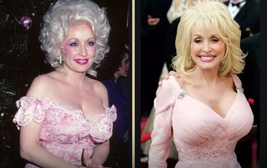 Dolly Parton Breast Implants