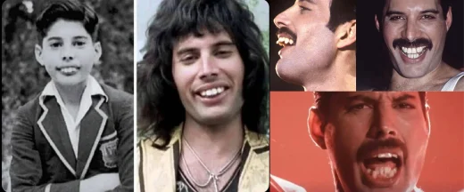 What’s the Story Behind Freddie Mercury’s Teeth?