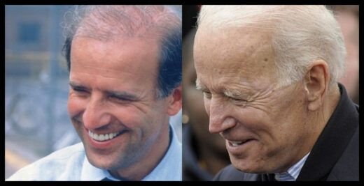 Did Joe Biden Really Get a Hair Transplant?