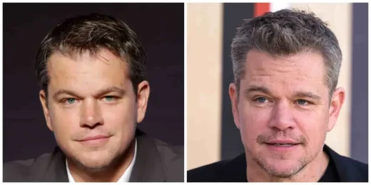 Matt Damon Hair Transplant: A Transformative Journey