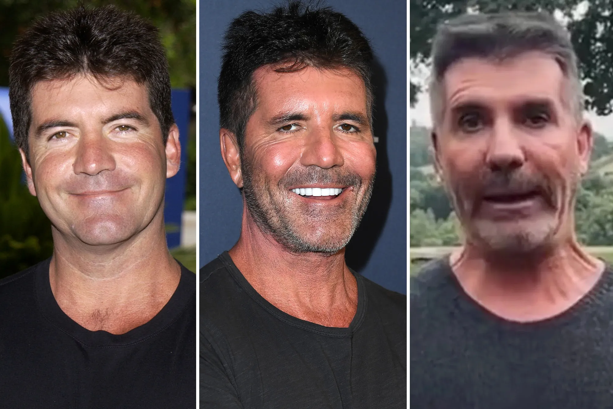 Le visage de Simon Cowell : hier et aujourd’hui avec des discussions sur la chirurgie plastique