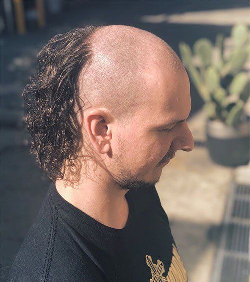 The Skullet