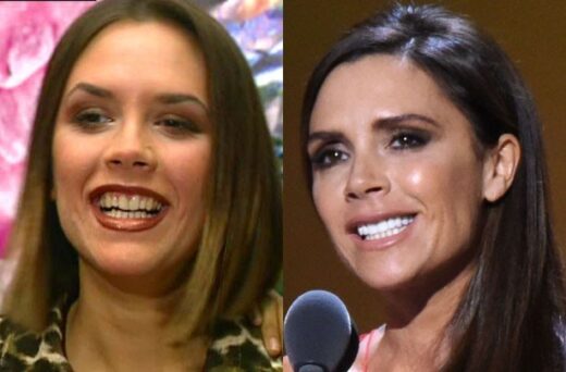 Victoria-Beckham-teeth veneers