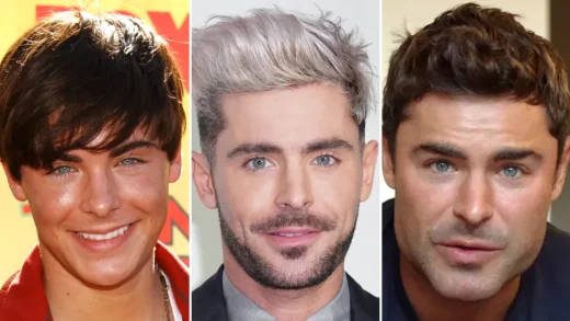 Did Zac Efron Have Plastic Surgery?