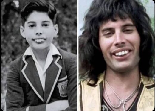 What’s the Story Behind Freddie Mercury’s Teeth?