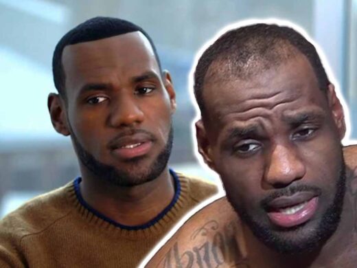 Did LeBron James Get a Hair Transplant?