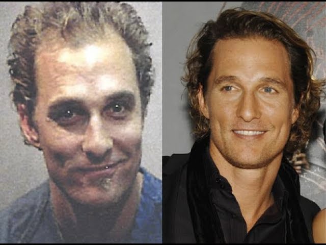 Did Matthew McConaughey Get Hair Treatment?