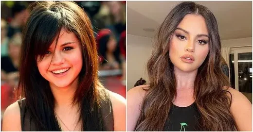 ¿Selena Gomez se hizo una cirugía plástica?