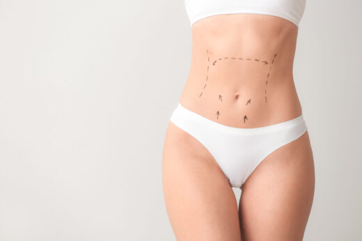 Tummy Tuck Surgery in Turkey