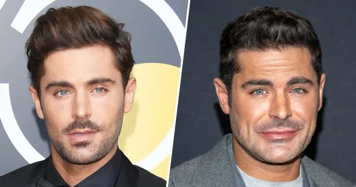 Zac Efron’s Explanation: The 2013 Jaw Injury