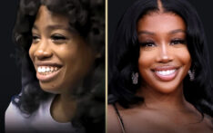 SZA’s Stunning Evolution: The Role of Cosmetic Enhancements in Her Appearance