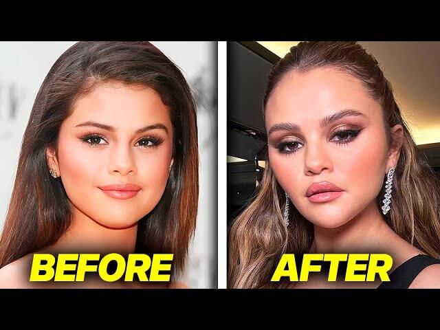 Selena Gomez and Plastic Surgery: Unraveling the Speculation