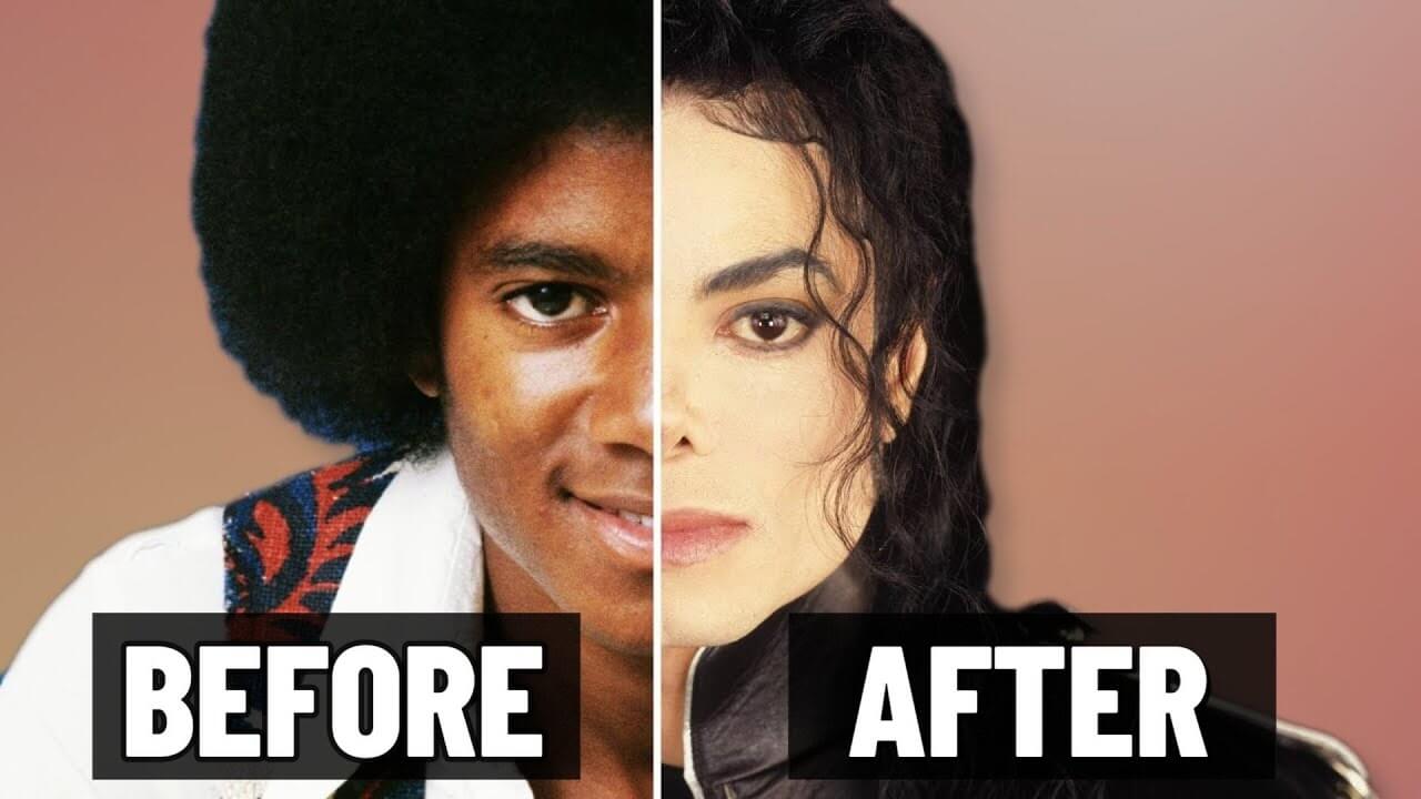 The Evolution of Michael Jackson’s Appearance: A Journey Through Cosmetic Procedures