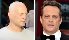 Vince Vaughn Hair Transplant