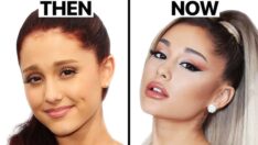 Ariana Grande's Alleged Cosmetic Enhancements: Then vs. Now