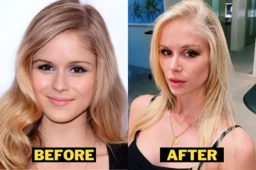 erin-moriarty-before-after