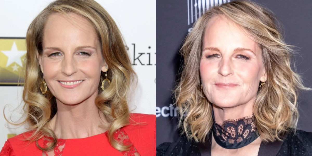 Helen Hunt’s Plastic Surgery: The Truth Behind the Speculation