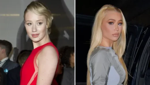 Iggy Azalea’s Plastic Surgery