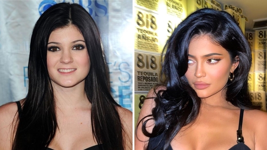 Kylie Jenner’s Transformation: A Deep Dive into Her Aesthetic Evolution