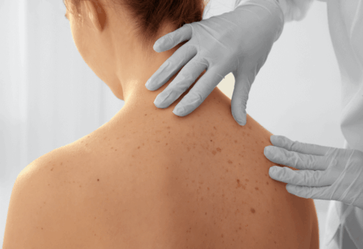 What Your Skin Is Trying to Tell You 6 What Your Skin Is Trying to Tell You