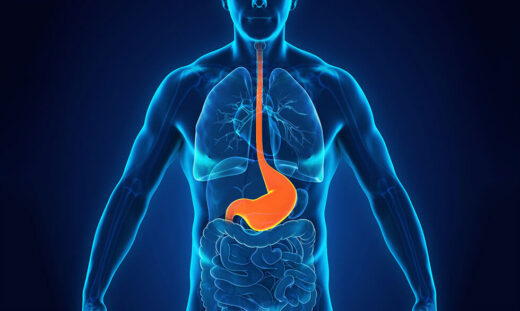 What Helps with Heartburn? Causes, Symptoms, and Real Solutions 5 What Helps with Heartburn