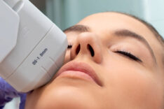 HIFU Treatment