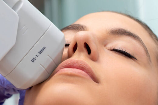 HIFU Treatment