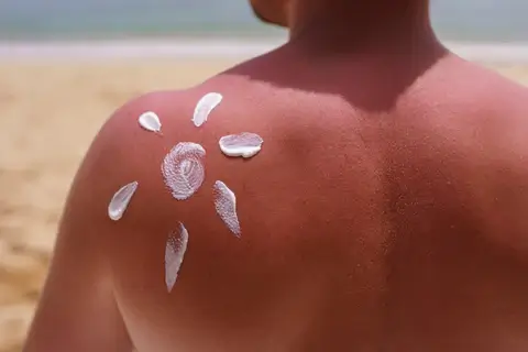 How to Protect and Soothe Male Skin During Hot Weather