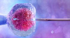 IVF-in vitro fertilization