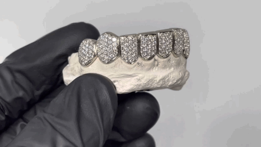 Lamar Jackson's grillz 