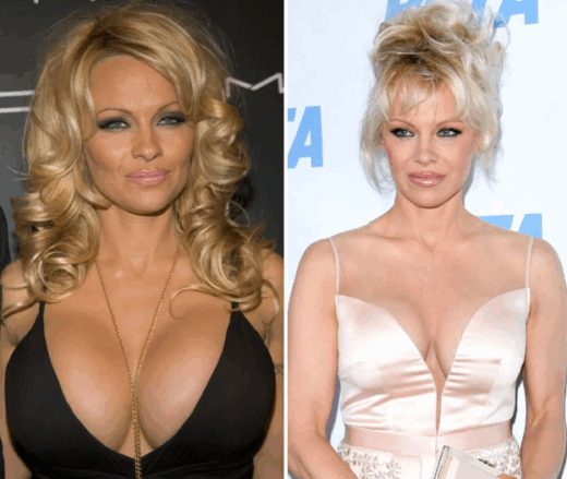 Paöela Anderson Breast Augmentation and Reduction