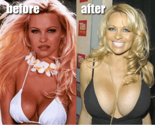Pamela Anderson 