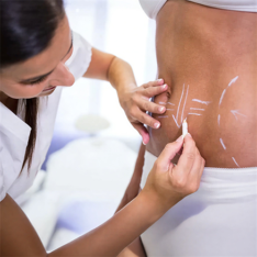 abdominoplasty recovery