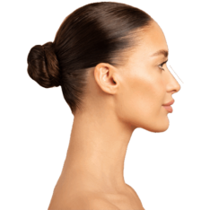 Rhinoplasty fillers